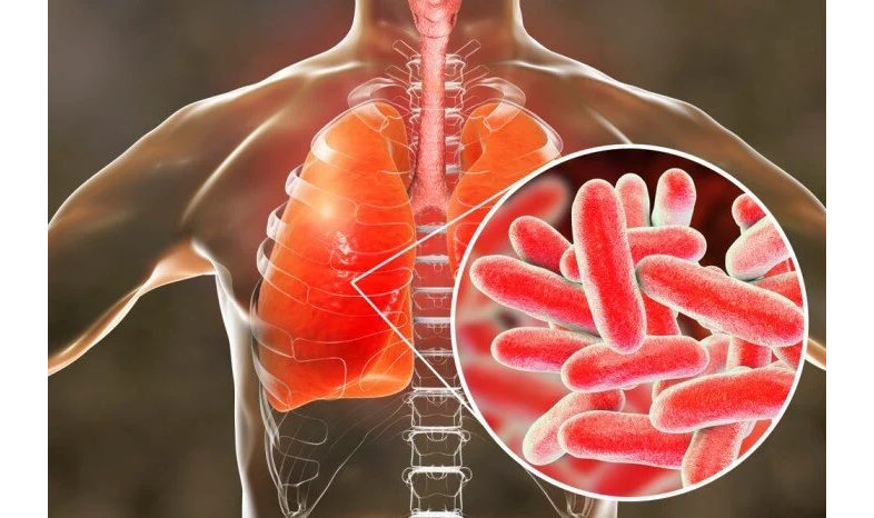 Bekæmpelse af Legionella