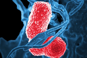 Legionella og temperaturgymnastik - En træningslejr?